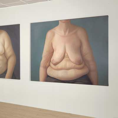Three large images of people's naked torsos