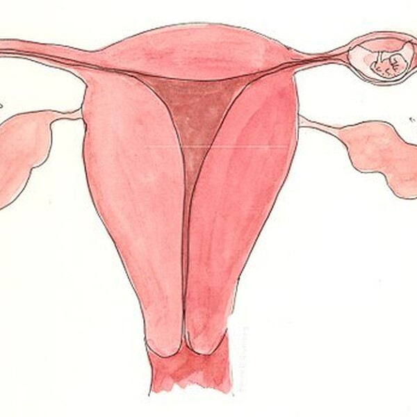 512px-Ectopic_pregnancy_in_Fallopian_tube