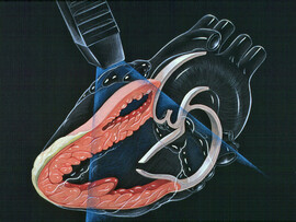 Heart_lpla_echocardiography_diagram