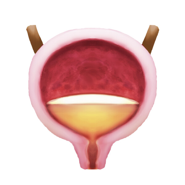 urinary incontinence