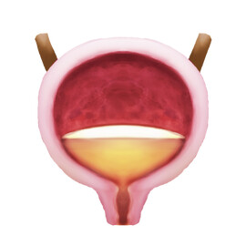 urinary incontinence