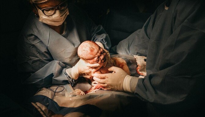 VBAC (Vaginal Birth After Cesarean) Basics | Our Bodies Ourselves