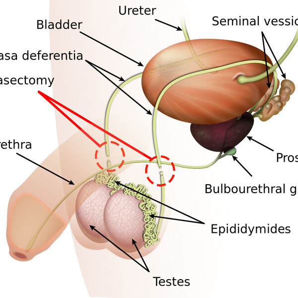 Vasectomy_diagram-en.svg