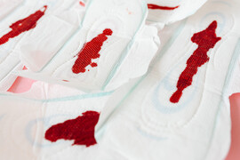 Unmet Menstrual Hygiene Needs Among Low Income Women scaled jpeg