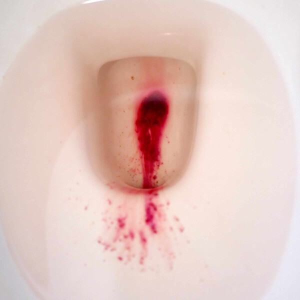 Navigating the Binary- A Visual Narrative of Trans and Genderqueer Menstruation