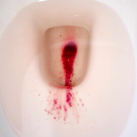 Navigating the Binary- A Visual Narrative of Trans and Genderqueer Menstruation