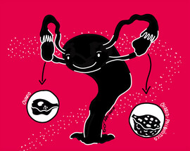 A cartoon drawing of a uterus holding on to ovaries.
