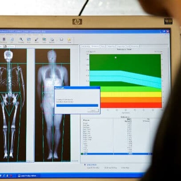 DEXA scan screen ALSPAC