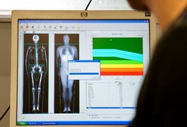 DEXA scan screen ALSPAC