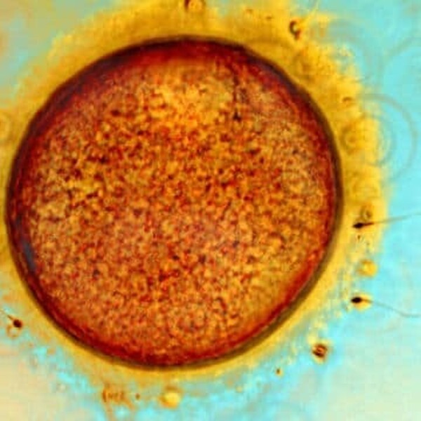Human egg and sperm Wellcome Images