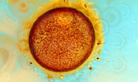Human egg and sperm Wellcome Images