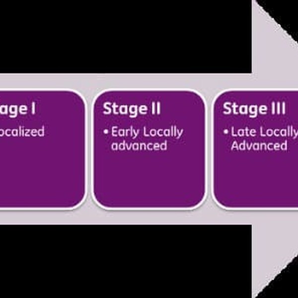 Stages of breast cancer