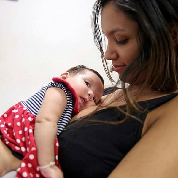 Zika baby
