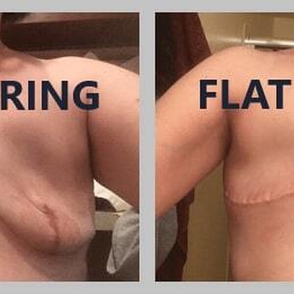 Skinsparingvsflat