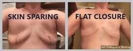 Skinsparingvsflat