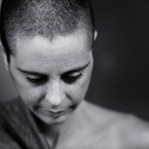 Woman mastectomy