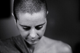 Woman mastectomy
